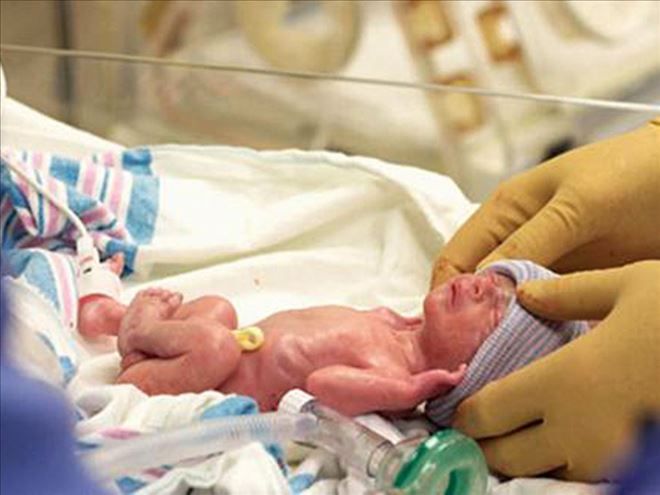 HER YIL 150 BİN BEBEK PREMATÜRE DOĞUYOR