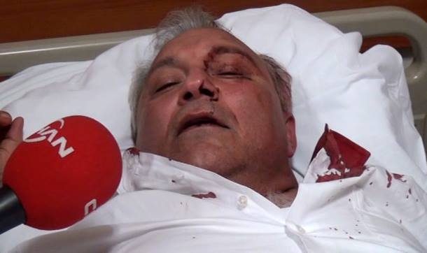 İlçe Başkanı Dövülerek Hastanelik Oldu 